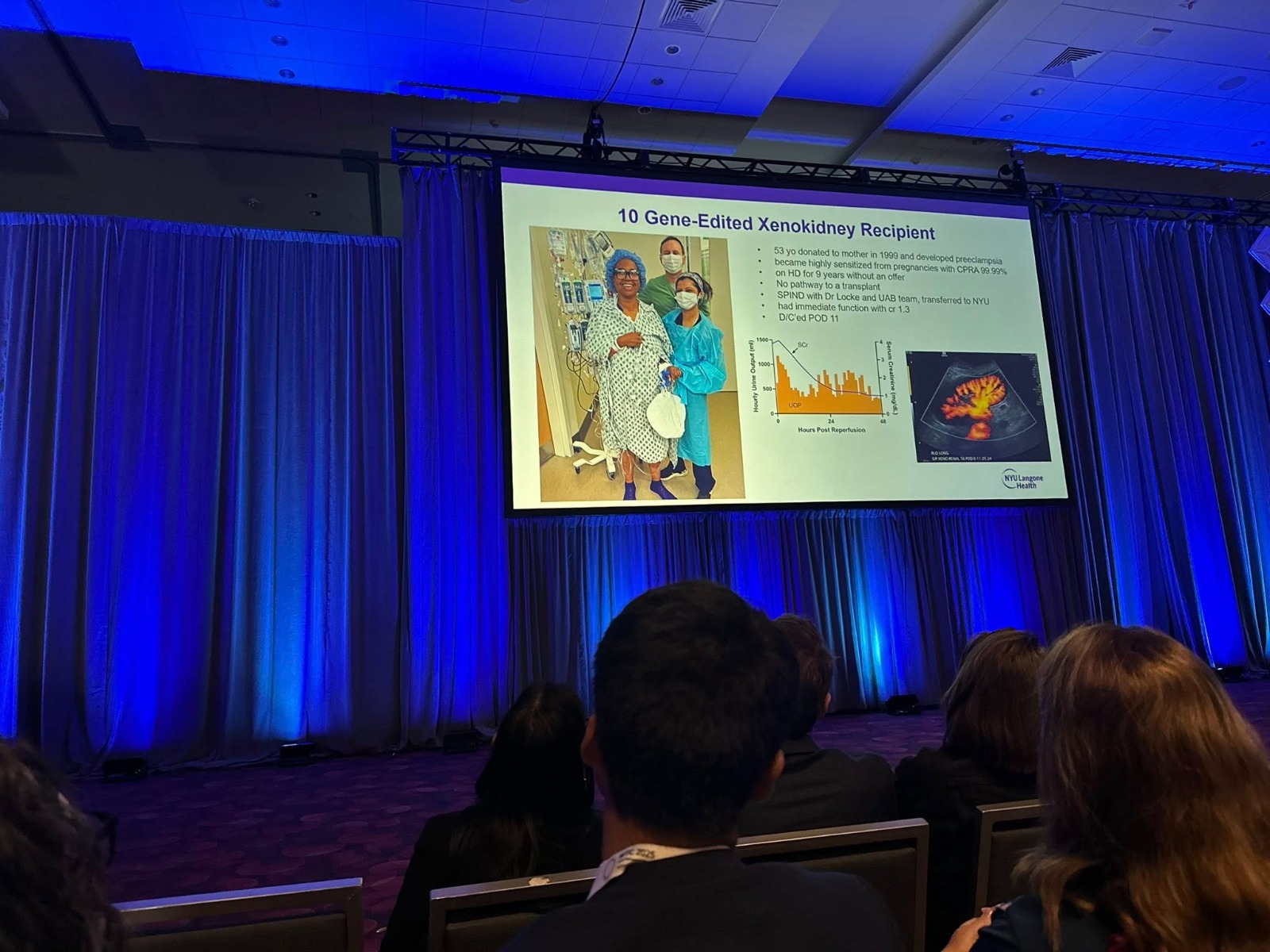 Azerbaijan’s kidney transplant experience was presented at the World Transplant Congress