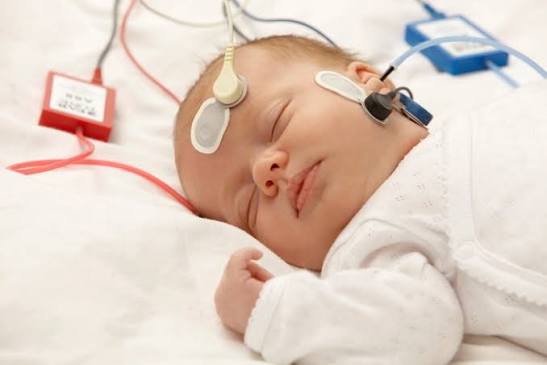 Uşaqlarda epilepsiyanın diaqnozu üçün yeni AI aləti hazırlanıb