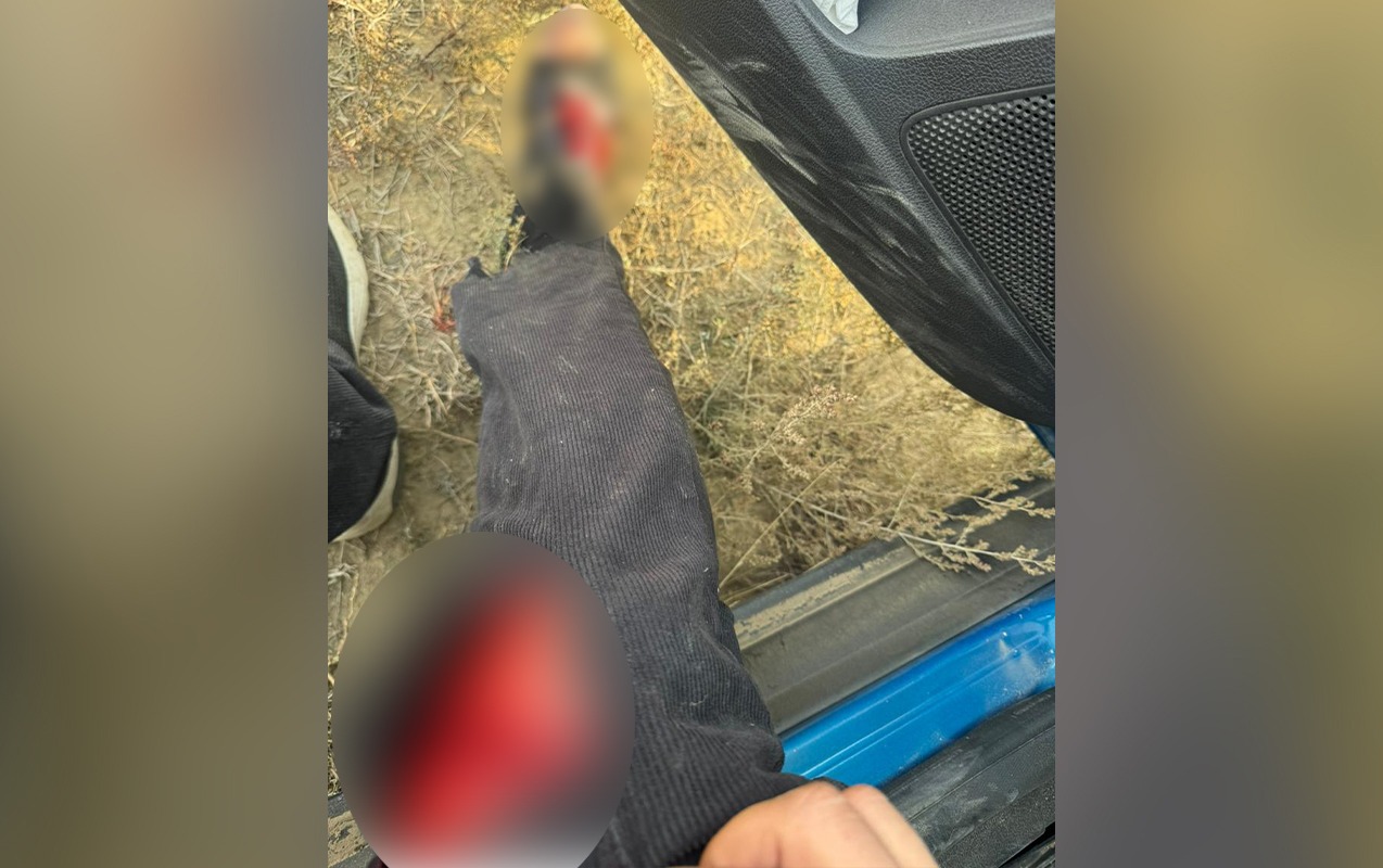 AzTV-nin müxbiri təyyarənin qəzaya düşdüyü ərazidə yaralandı 