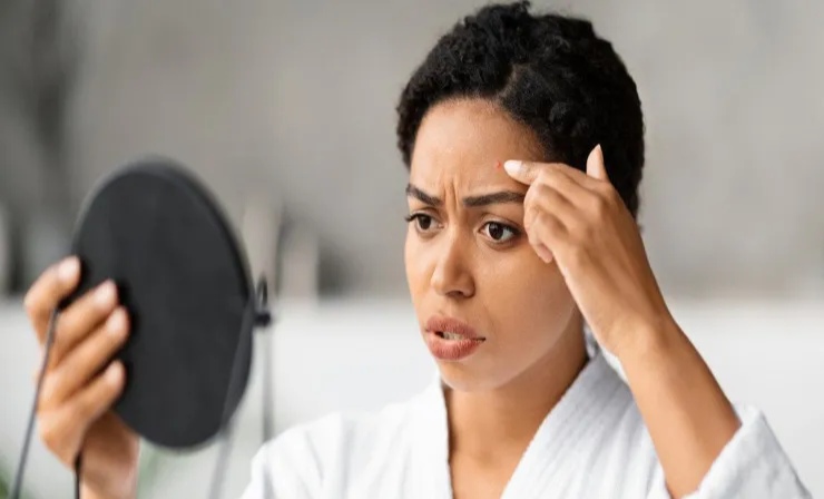 Həyatınızı məhv edən az bilinən dəri xəstəliyi