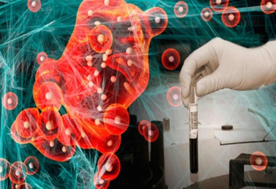 Tədqiqatçılar qaraciyər xərçənginin diaqnostikası və proqnozlaşdırılmasında süni intellektin rolunu araşdırırlar