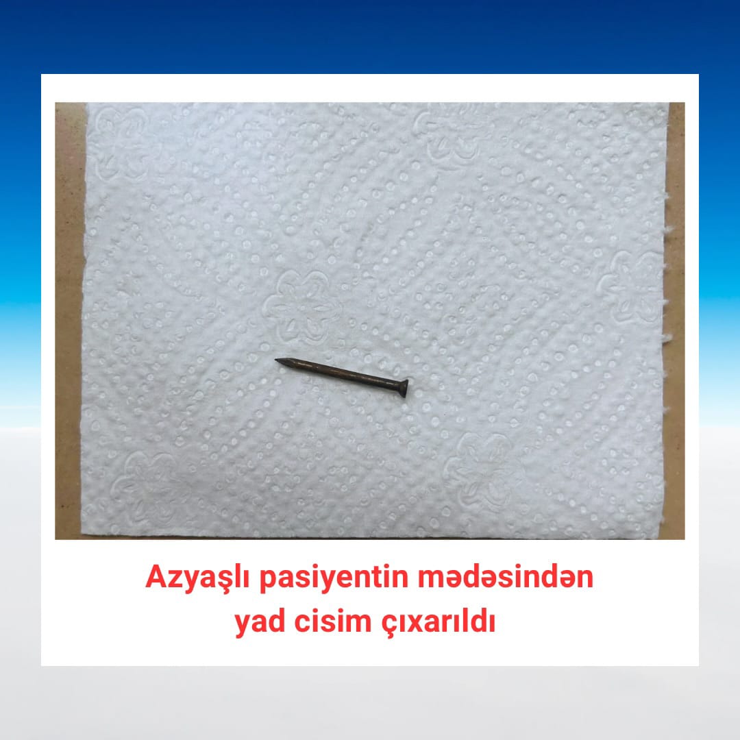 Bakıda azyaşlının mədəsindən yad cisim çıxarıldı