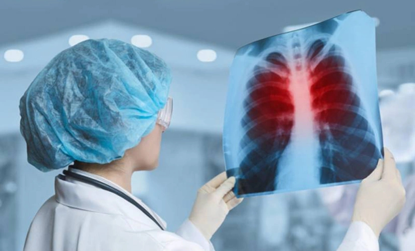 Bu qida ağciyəri təmizləyir