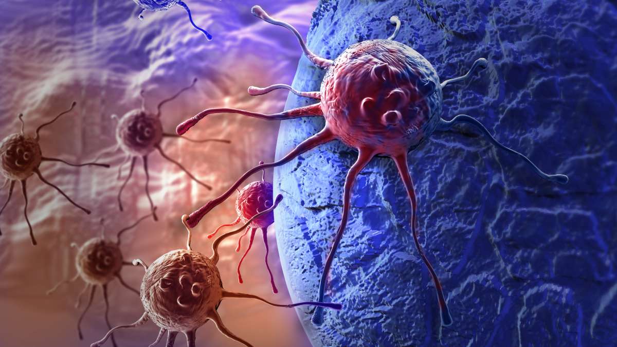 Xərçəng xəstəliyi son 30 ildə iki dəfə artıb