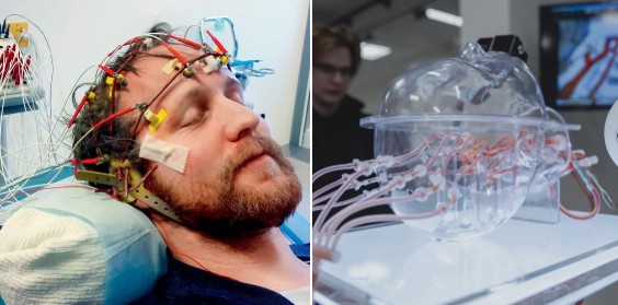 Yuxuda diaqnoz dövrü başlayır: süni intellekt 130 xəstəliyi əvvəlcədən görür