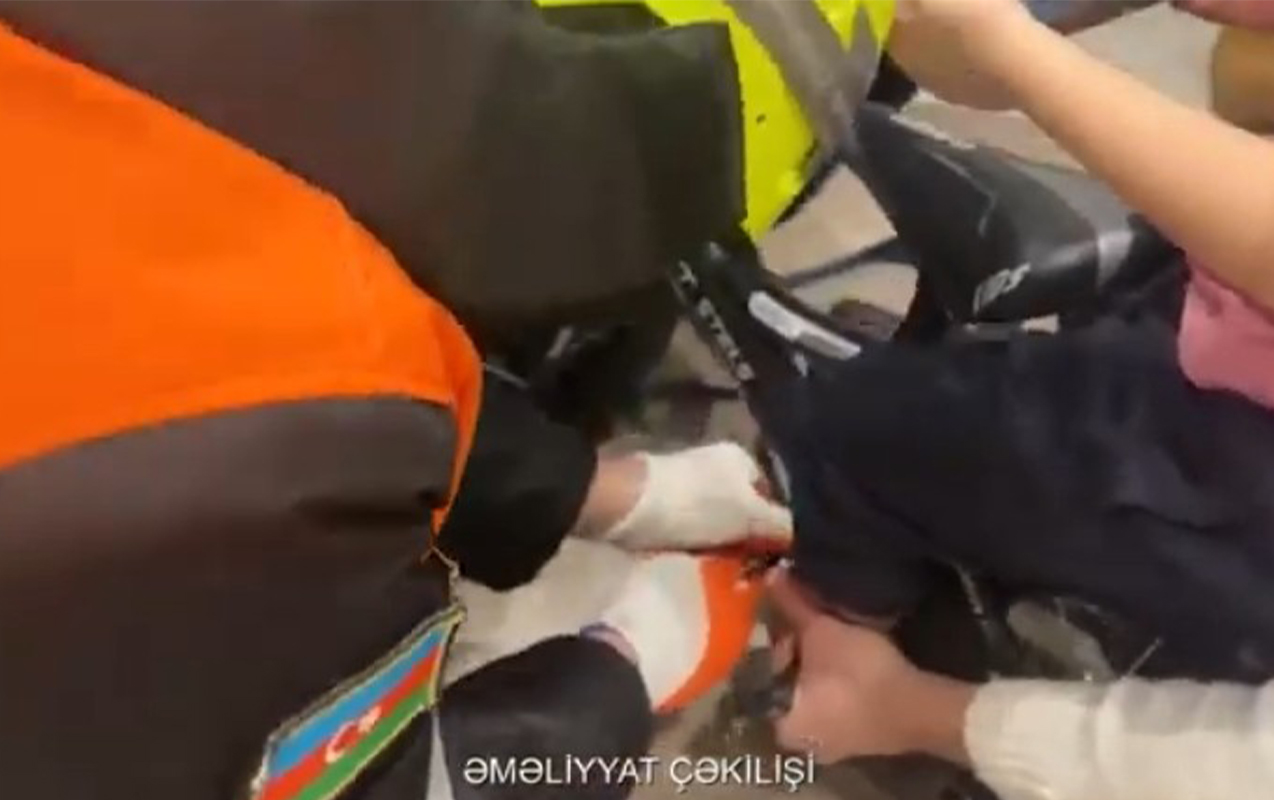 Nizami rayonunda 4 yaşlı uşağın ayağı velosipedin pedalında sıxılıb - VİDEO