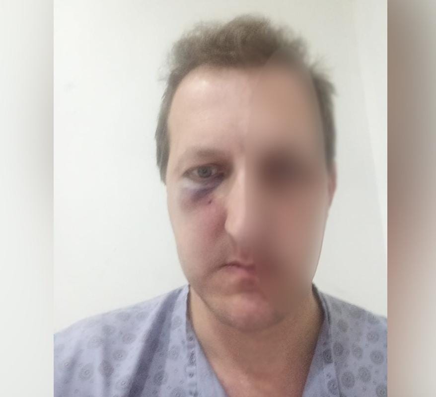 Binəqədidə döyülən Artur Balıyev ambulator müalicəyə göndərildi