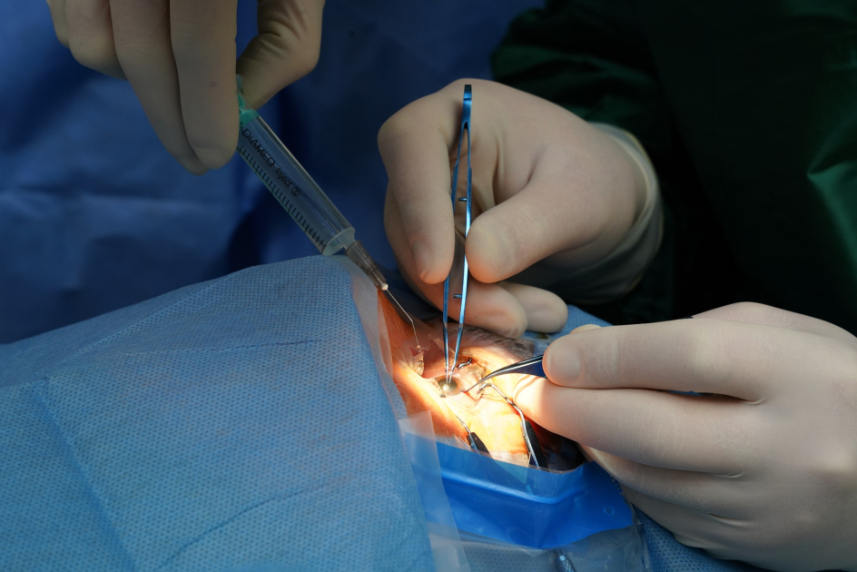 Quba Rayon Mərkəzi Xəstəxanasında ilk dəfə oftalmoloji əməliyyat icra edilib