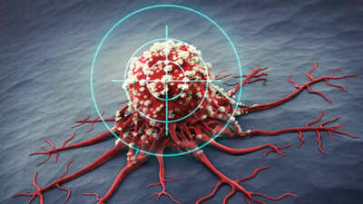 Stressin xərçəngə səbəb olduğu isbat olundu