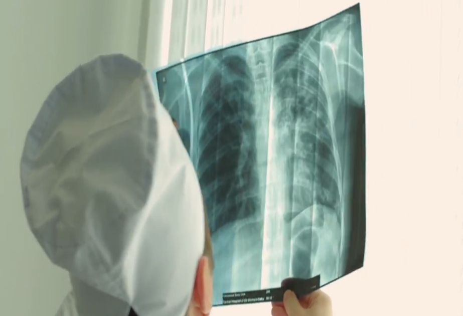 Azərbaycanda uşaq və yeniyetmələrin vərəmlə xəstələnmə göstəriciləri aşağı düşüb