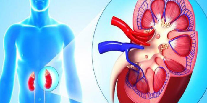 Böyrək çatışmazlığının ilk əlamətləri