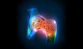 Osteoporozun inkişafını zəiflətməyin yolu aşkar edilib - Tədqiqat