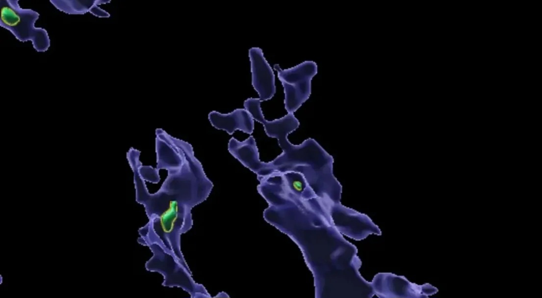 Alimlərdən mikroplastiklə bağlı yeni tədqiqat