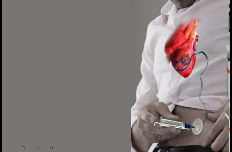 İnfakrtdan sonra ürəyi bərpa edəcək iynə hazırlandı