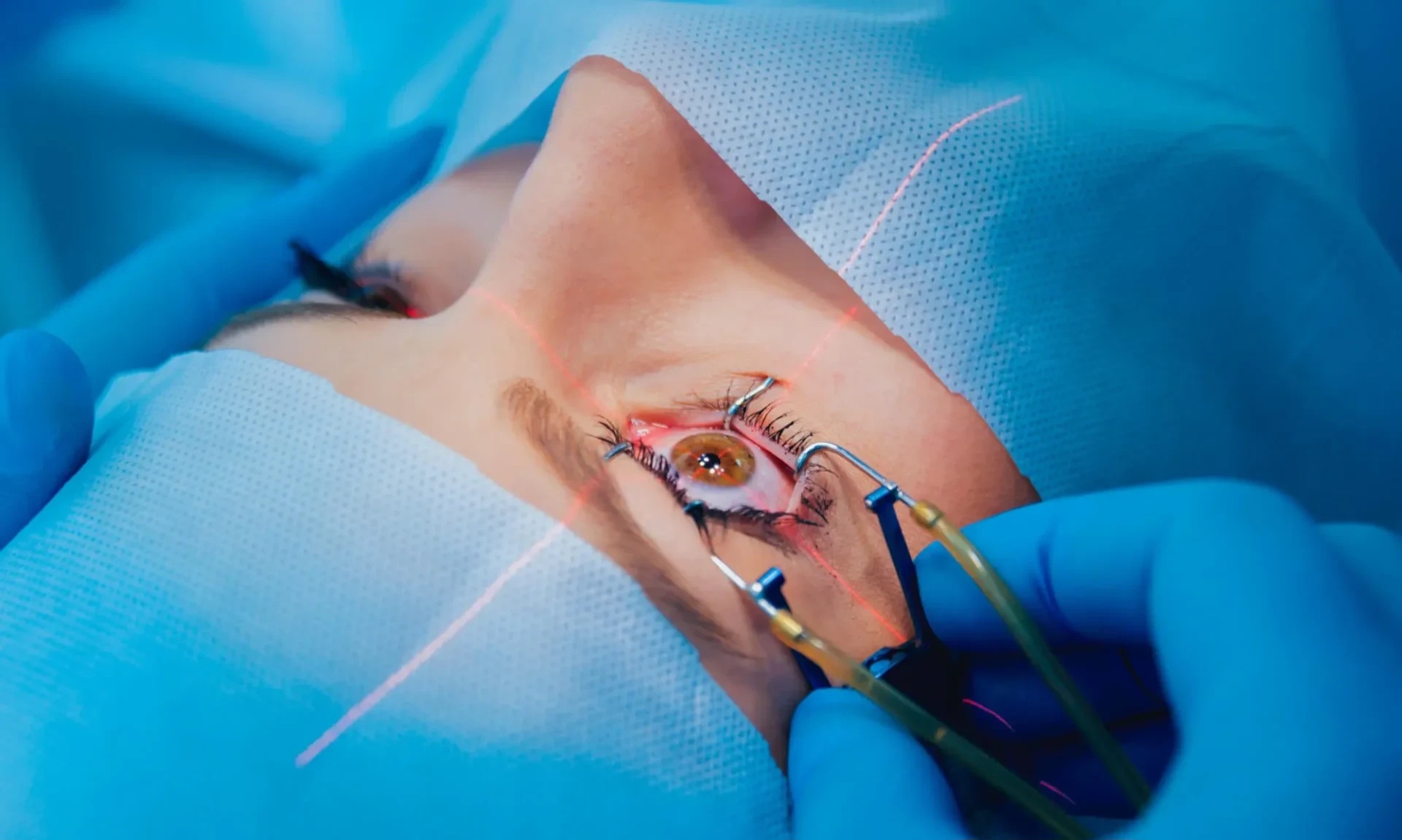 Əsl göz kimi hərəkət edən süni göz hazırlandı