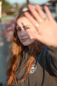 Rusiyalı həkimdən xəbərdarlıq: Bahar günəşi dərinizə ciddi zərər verə bilər