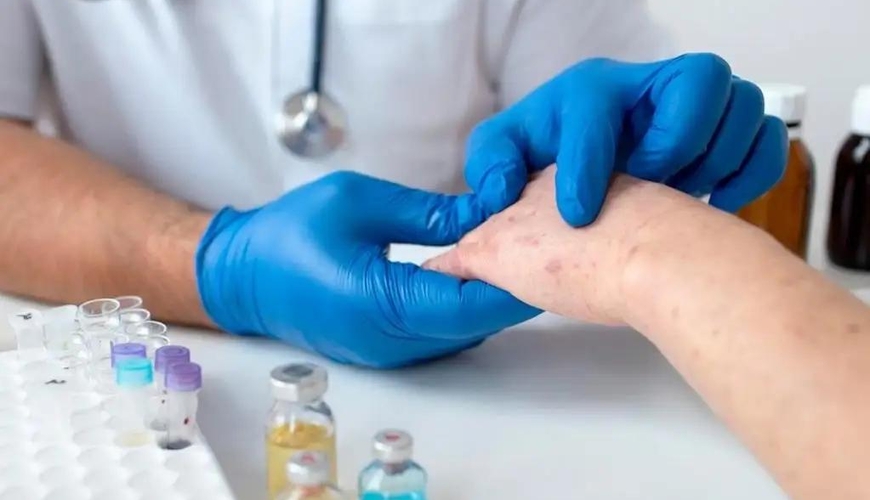 Tibbdə inqilab: insultla mübarizədə 40% azalma təmin edən yenilik